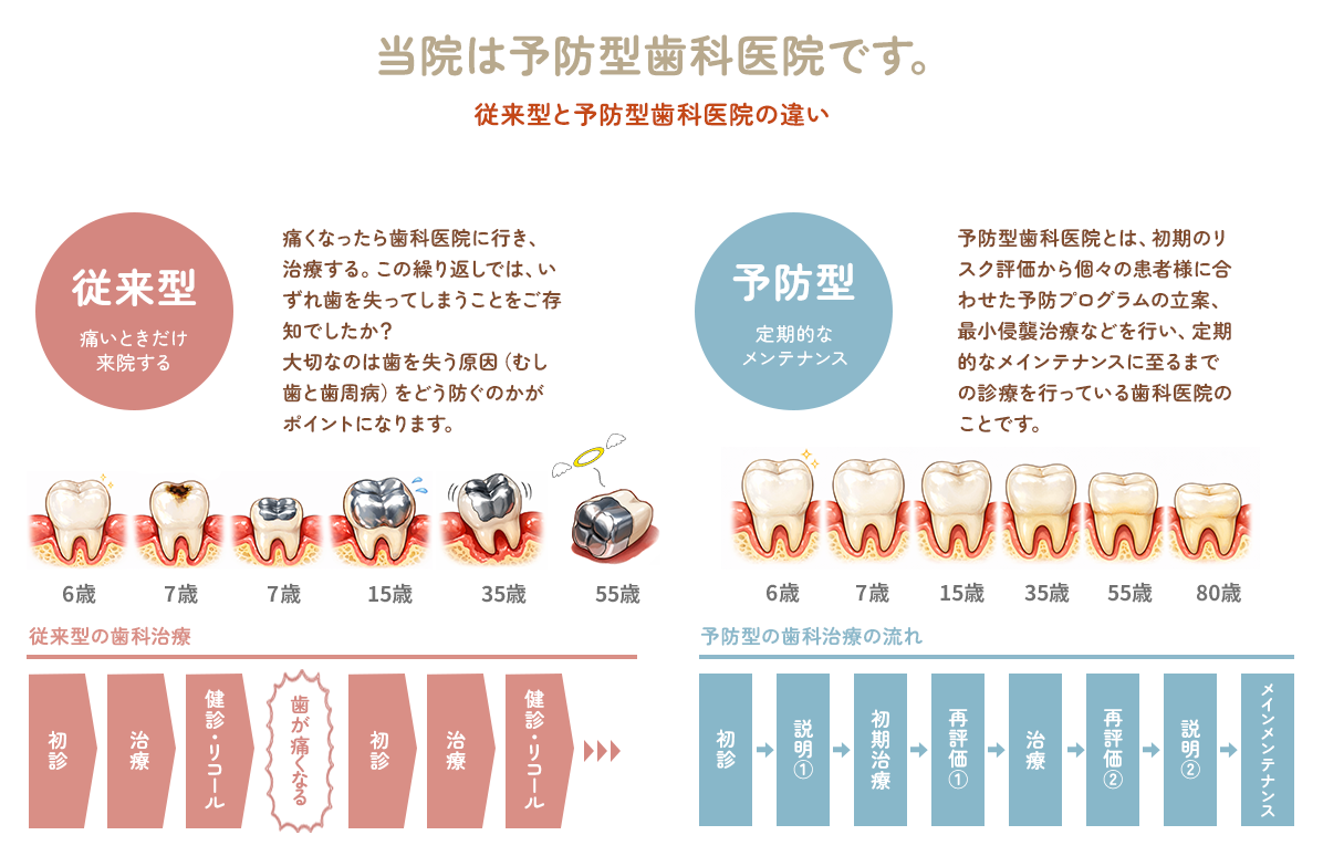 従来型と予防型歯科医院の違い